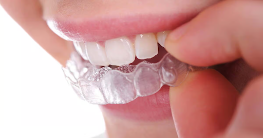 Invisalign London